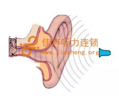 助听器如何应对堵耳效应-堵耳效应是一个古老而永久的话题