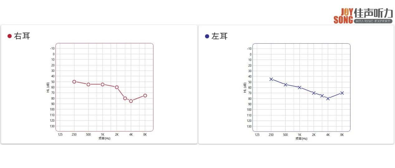 成人听力康复案例分享