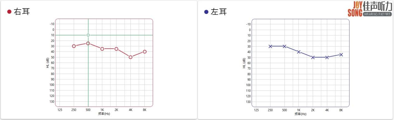 老年人佩戴助听器参与社交的康复策略分享